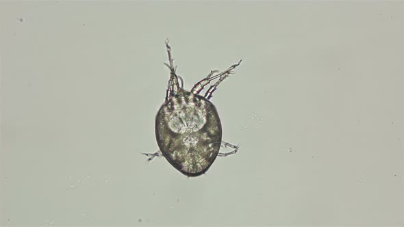 Acari (Mite) Myianoetus Sp. Under the Microscope, Deutonymph, of the Histiostomatidae Family