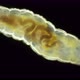 Wormlike Larva of a Fly Midge Insect of the Order Diptera Under a Microscope Suborder Brachycera - VideoHive Item for Sale