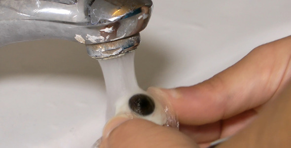 Washing Glass Eye Prosthesis 2