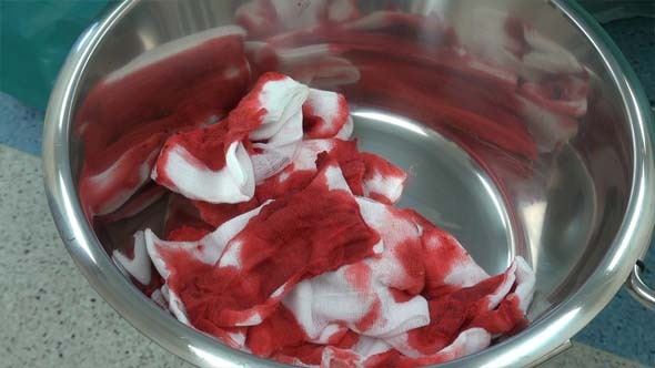 Blood Tupfer Or Swab alt