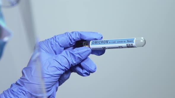 Omicron test positive sars – cov-2 epidemic