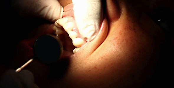 Young Girl in Dentist