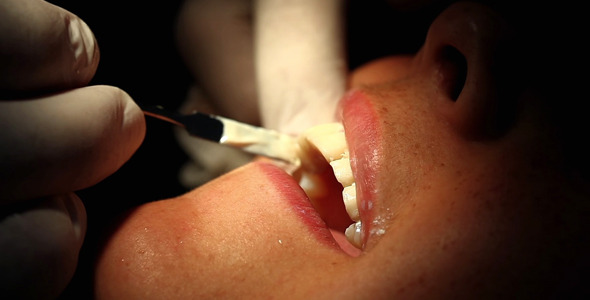 Young Girl in Dentist 8