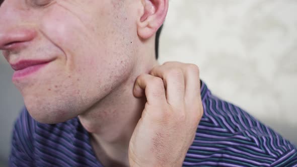 çMan Scratching Itchy Reddened Neck