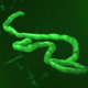Ebola Virus - VideoHive Item for Sale
