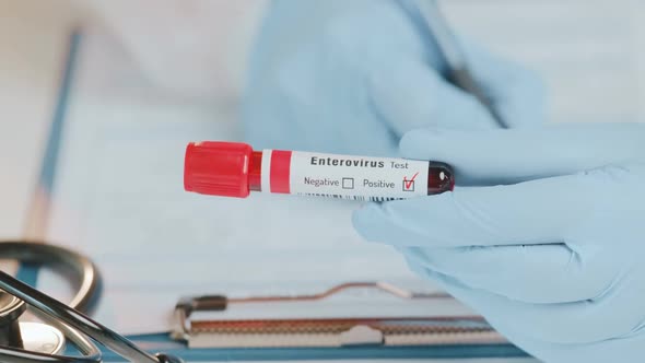 Doctor Holds in Hand Laboratory Positive Blood Test Tube with Enterovirus