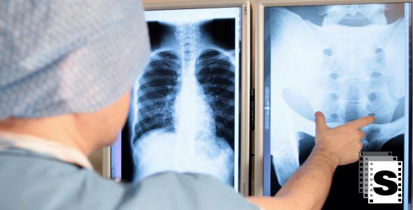 Surgeon Examine X-ray alt