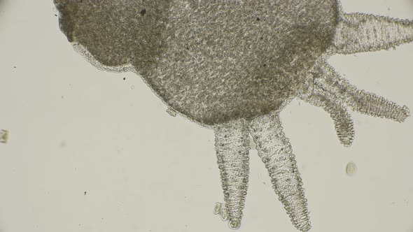 Colony of Infusorians of Trichodin Move and Move Along the Hydra and Near It, Under a Microscope