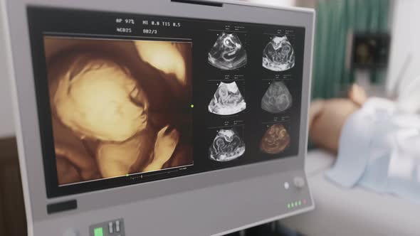 Monitoring device checking womans health during pregnancy at a healthcare center alt