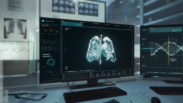 Anatomical Scan System Conducts Analysis Of Cancer Disease In Human Lungs