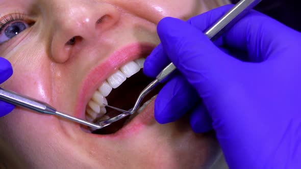 Close Up of Dentist Examining a Patient's Teeth