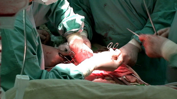Surgeons Hands
