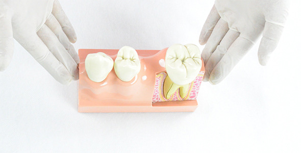 Hands Showing Patient Education Dental Model