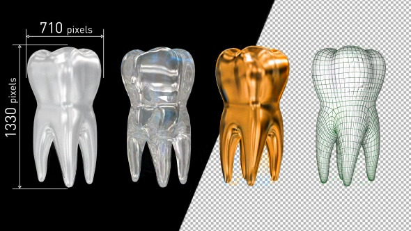 4 Tooth: Porcelain Glass Gold Mesh