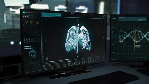Scientific Patient Lung Cancer Illness Research By Laboratory Scanning Equipment alt