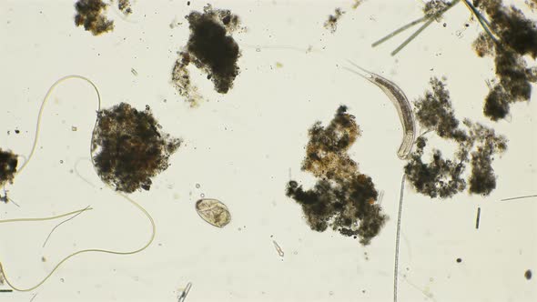 Anaerobic Ciliate Brachonella and Worm Gastrotricha alt