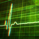 Heartbeat Monitor Backgrounds - VideoHive Item for Sale