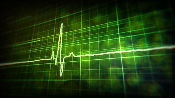 Heartbeat Monitor Backgrounds alt