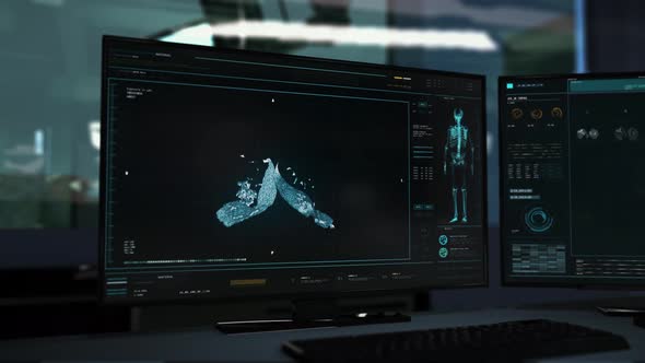 Computer medical diagnosis technology has found deadly lung cancer disease alt