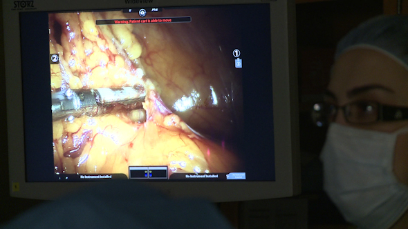 Robotic Surgery Of The Uterus (4 Of 15)