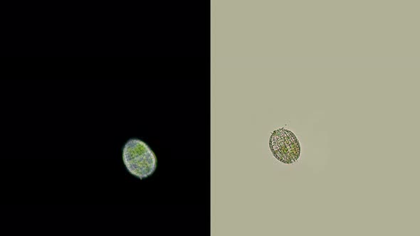 Infusoria Coleps Under the Microscope, Family Colepidae, Class Prostomatea, Feeds on Bacteria, Algae