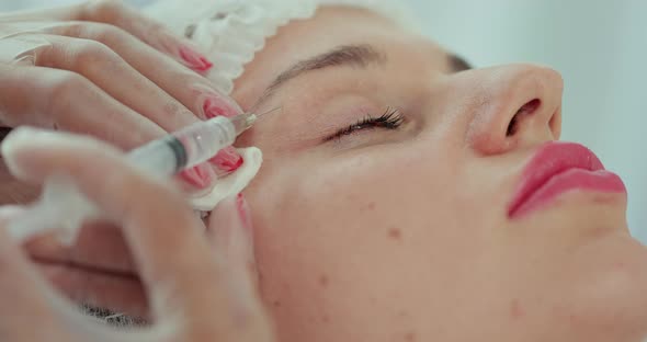 Beautician Doctor Makes Injections Into the Skin of the Face of a Young Beautiful Woman