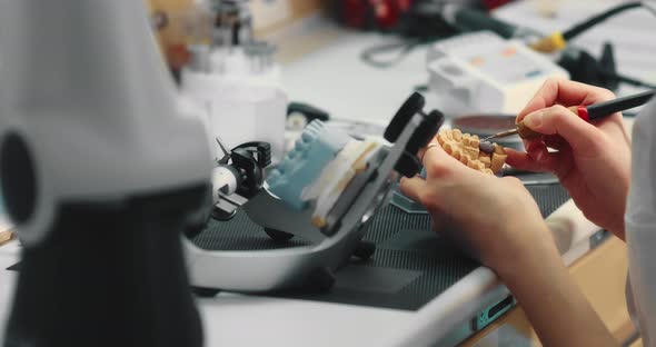 Dental Technician Makes a Plaster Cast of Jaw Models in an Articulator