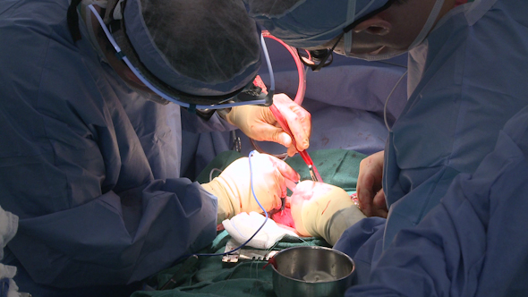 Surgeons Use Cell-Salvage During Open Heart Surgery