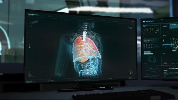 Doctor Examines Lungs Condition In Medical Software To Detect Epidemic Disease