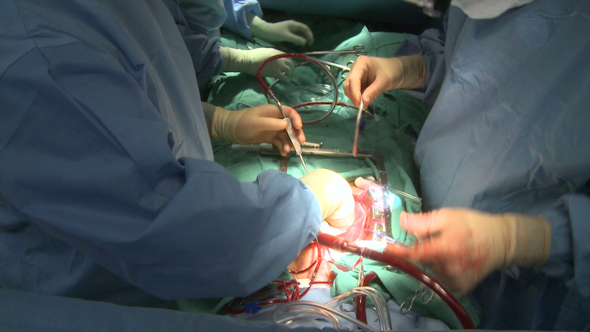 Surgeons Work Together On Heart Patient (12 Of 12)
