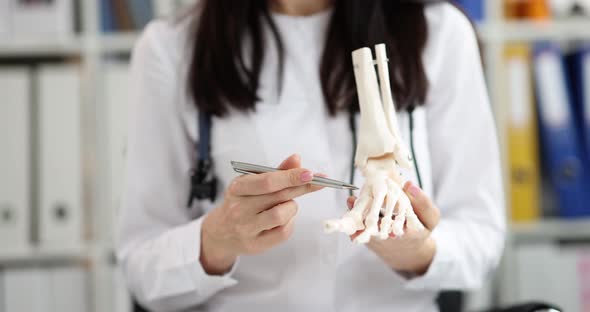 Foot Bone Model in Hands of Doctor in Orthopedic Clinic