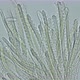 Polychaeta worm, family Sabellidae under a microscope. Filter - VideoHive Item for Sale