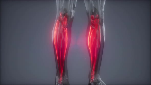 Gastrocnemius- Visible Muscle Anatomy Map