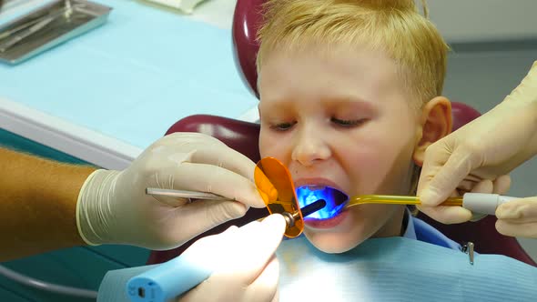 Health Concept. Boy at Dental Clinic Gets Dental Treatment To Fill a Cavity in Tooth. Dental