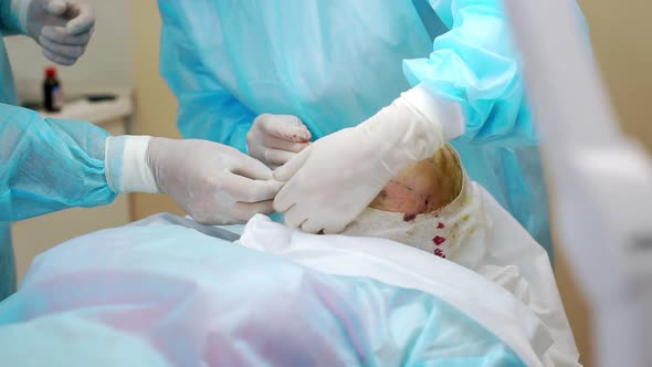 Picture of Team of Professionals Touching Examining Face of Adult Woman Lying on Table in Operating