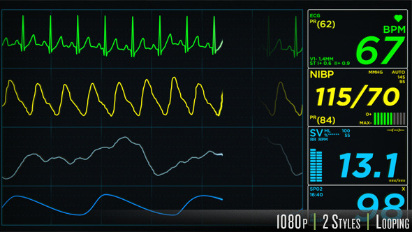EKG Display Monitor
