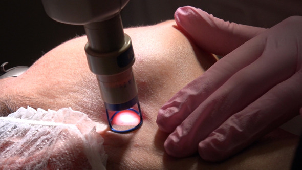 Laser Therapy for Face and Body Contouring 2