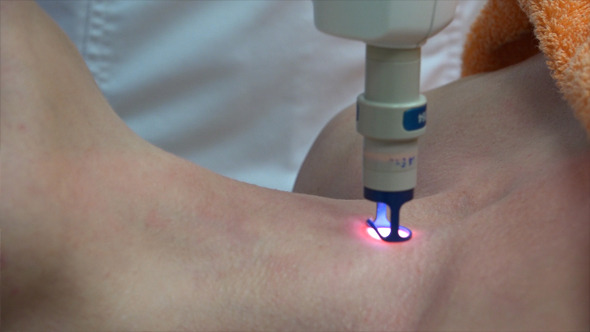 Laser Therapy for Face and Body Contouring 3