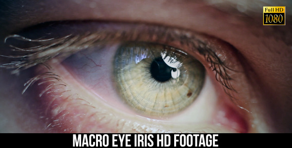 Eye Iris 7