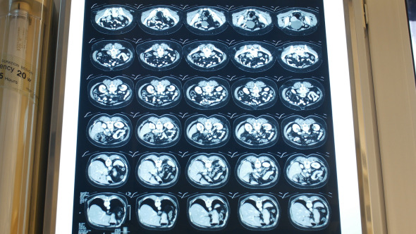 Putting On Light Results Of A Magnetic Tomography