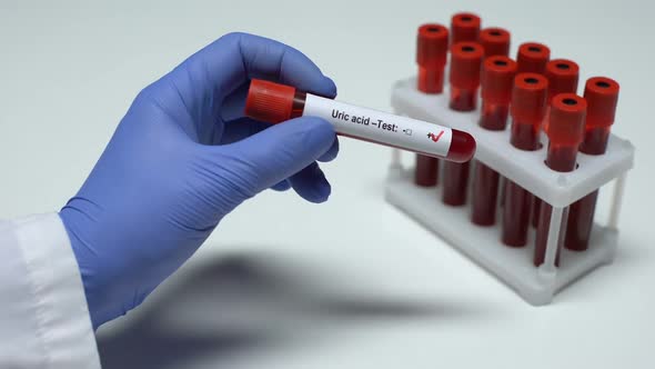 Positive Uric Acid Test, Doctor Shows Blood Sample, Lab Research, Health Checkup