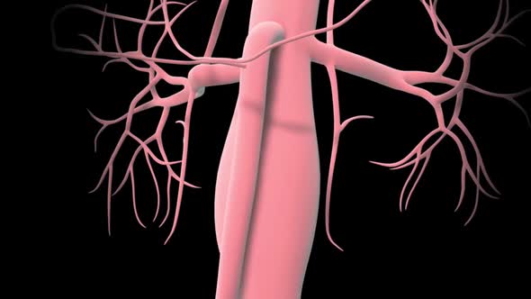 Formation of abdominal aortic aneurysm