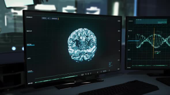 Monitor Displays Advanced Disease Scan Interface Used To Localise Brain Tumor