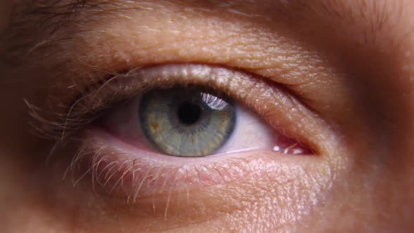 A close-up of a woman's blue eye with a contact lens looks directly at the camera