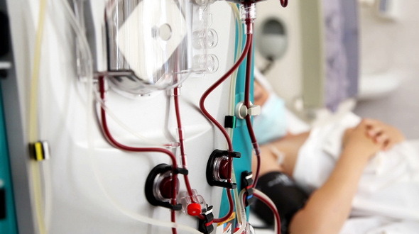 Patient at Blood Purification Medical Procedure