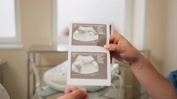 Closeup Shot Woman's Hands Holding Sonogram Image of Healthy Unborn Baby