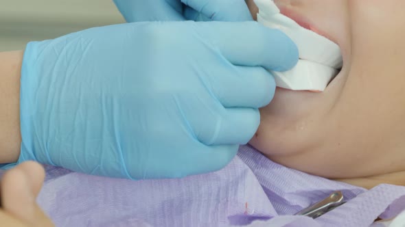 Close-up of a little girl's mouth at the dentist during a dental check and fluoride application