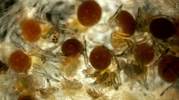 Spider under a microscope, Arachnida class, Arthropoda squad