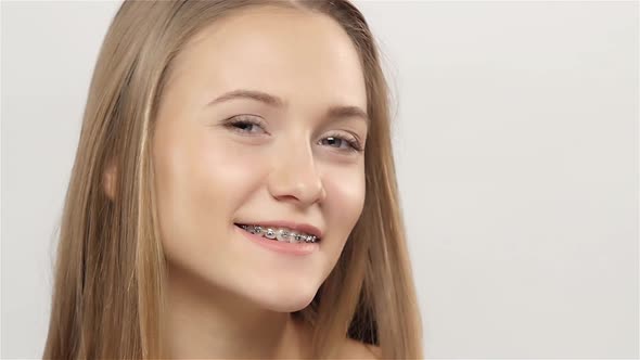 Girl Shows Her Smile Braces, White, Slow Motion
