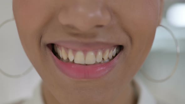 Close Up of Mouth of Smiling Young African Girl